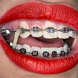 Cassy Braces — OnlyFans